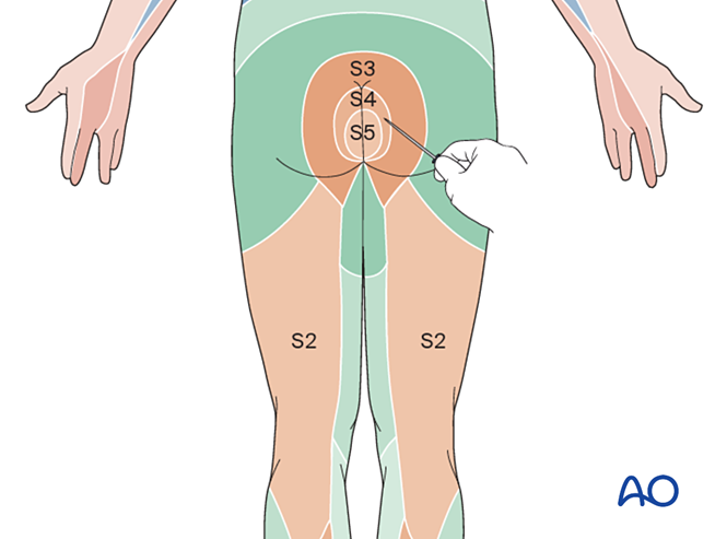 Perianal sensation